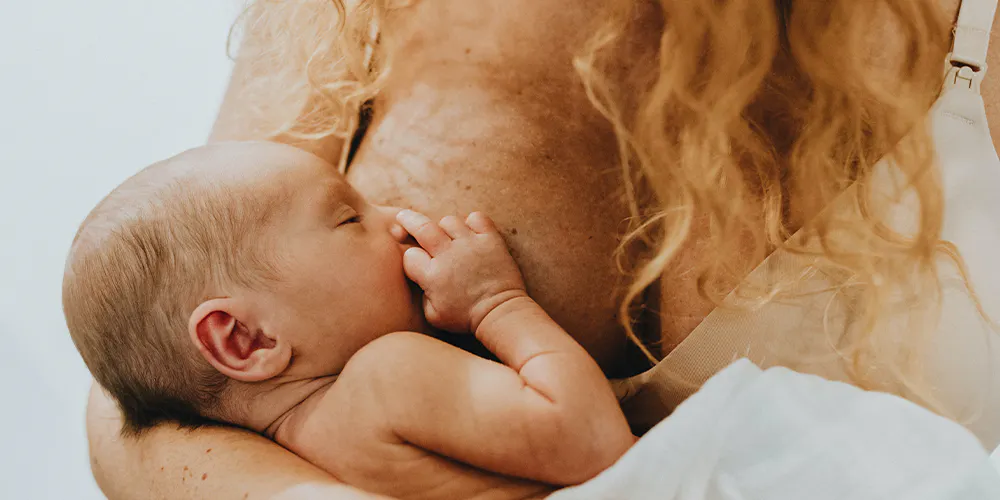 What to consider when breastfeeding and eczema collide