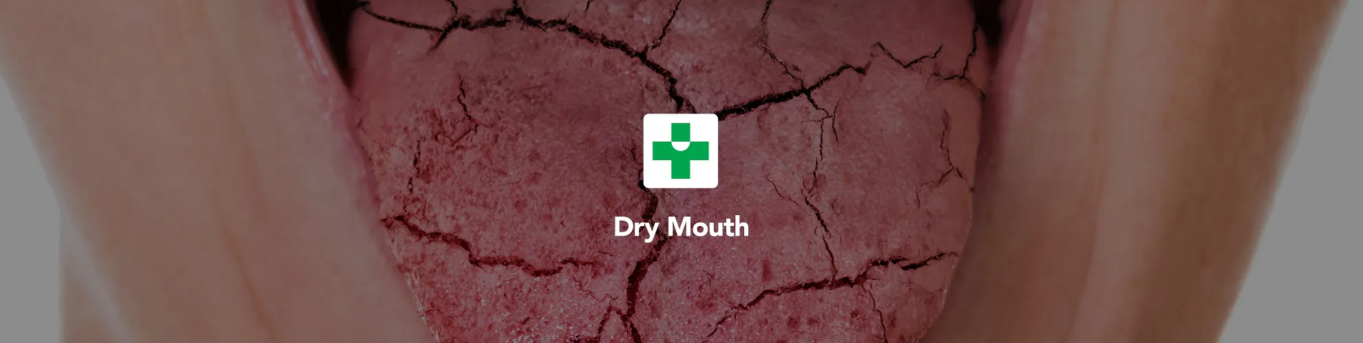 Dry Mouth