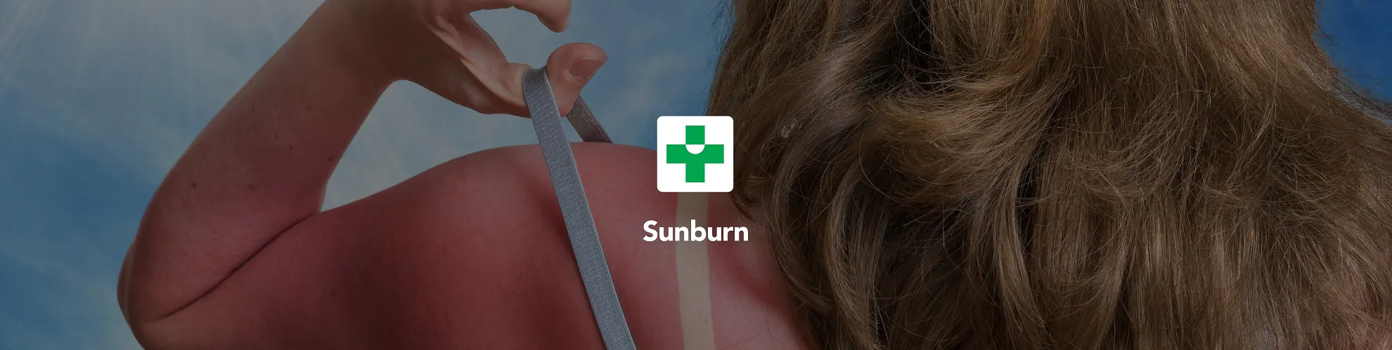 Sunburn