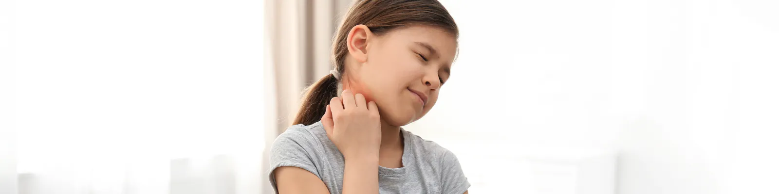 Does your child have eczema? Use 7 tips to boost confidence when away from home