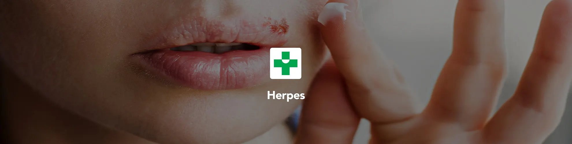 Herpes
