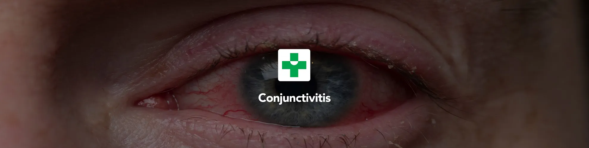 Conjunctivitis | TerryWhite Chemmart