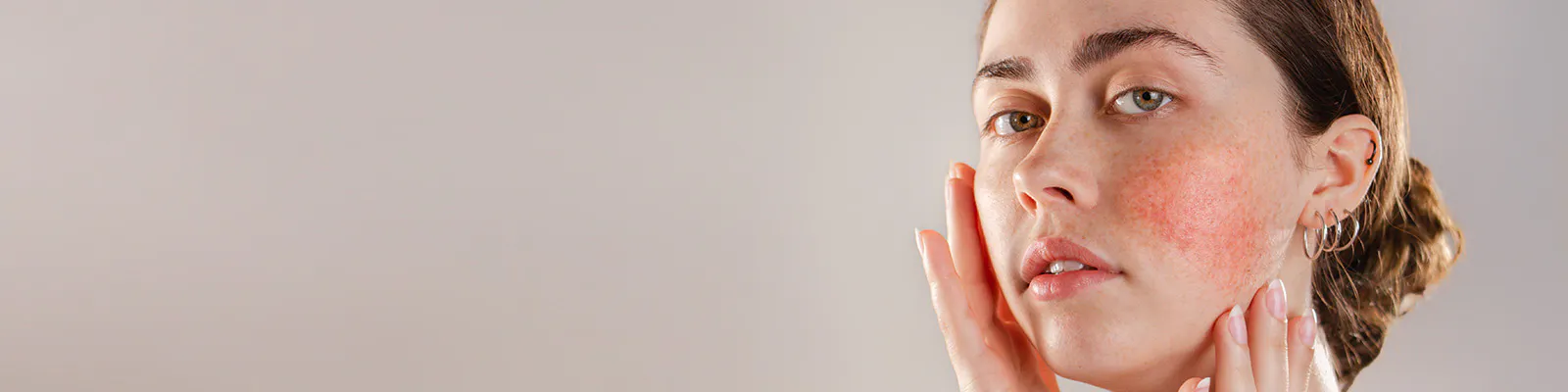 10 questions about sensitive skin, answered