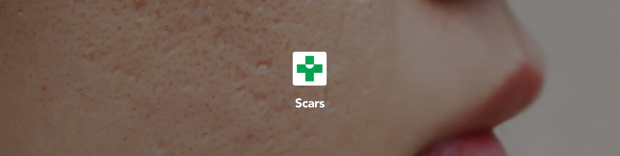 Scars