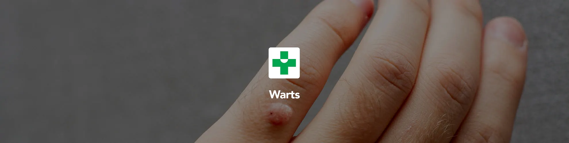 Warts