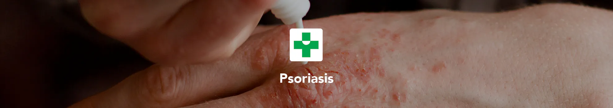 Psoriasis