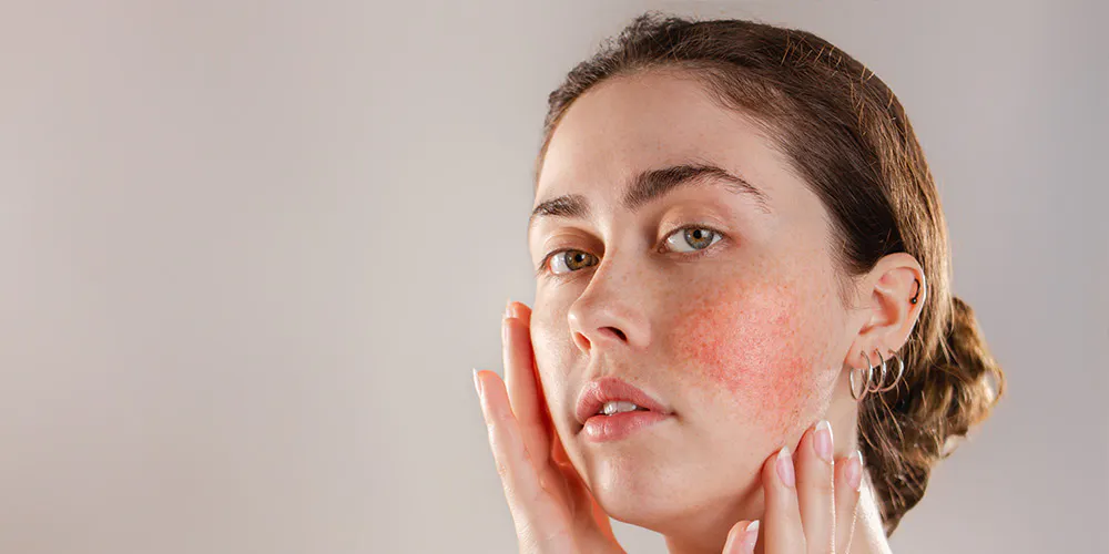 10 questions about sensitive skin, answered