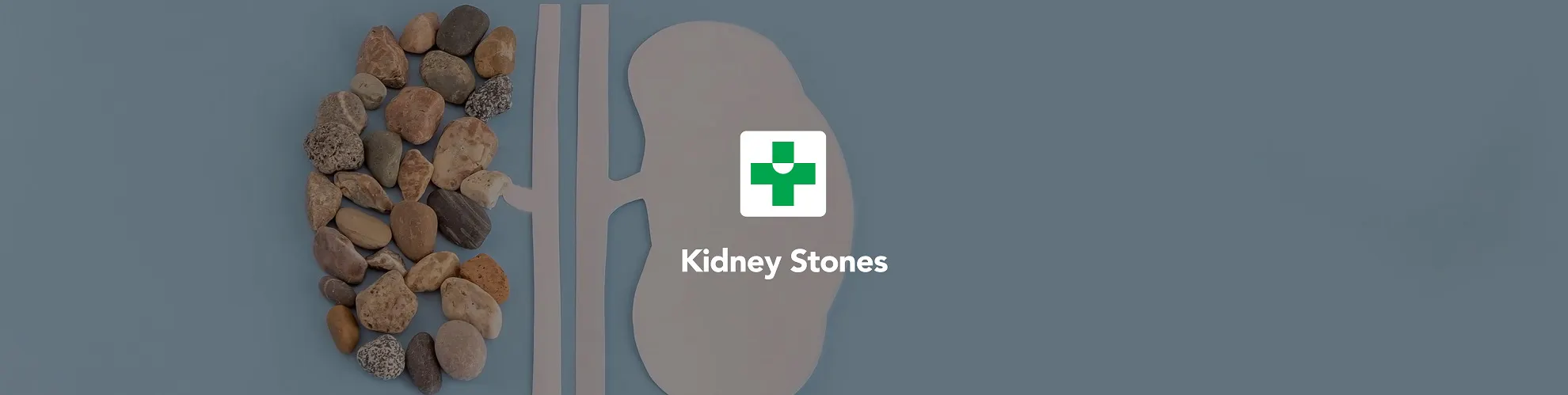 Kidney stones