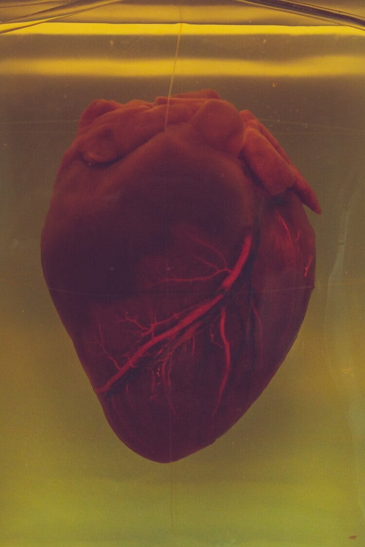 Matters of the Heart