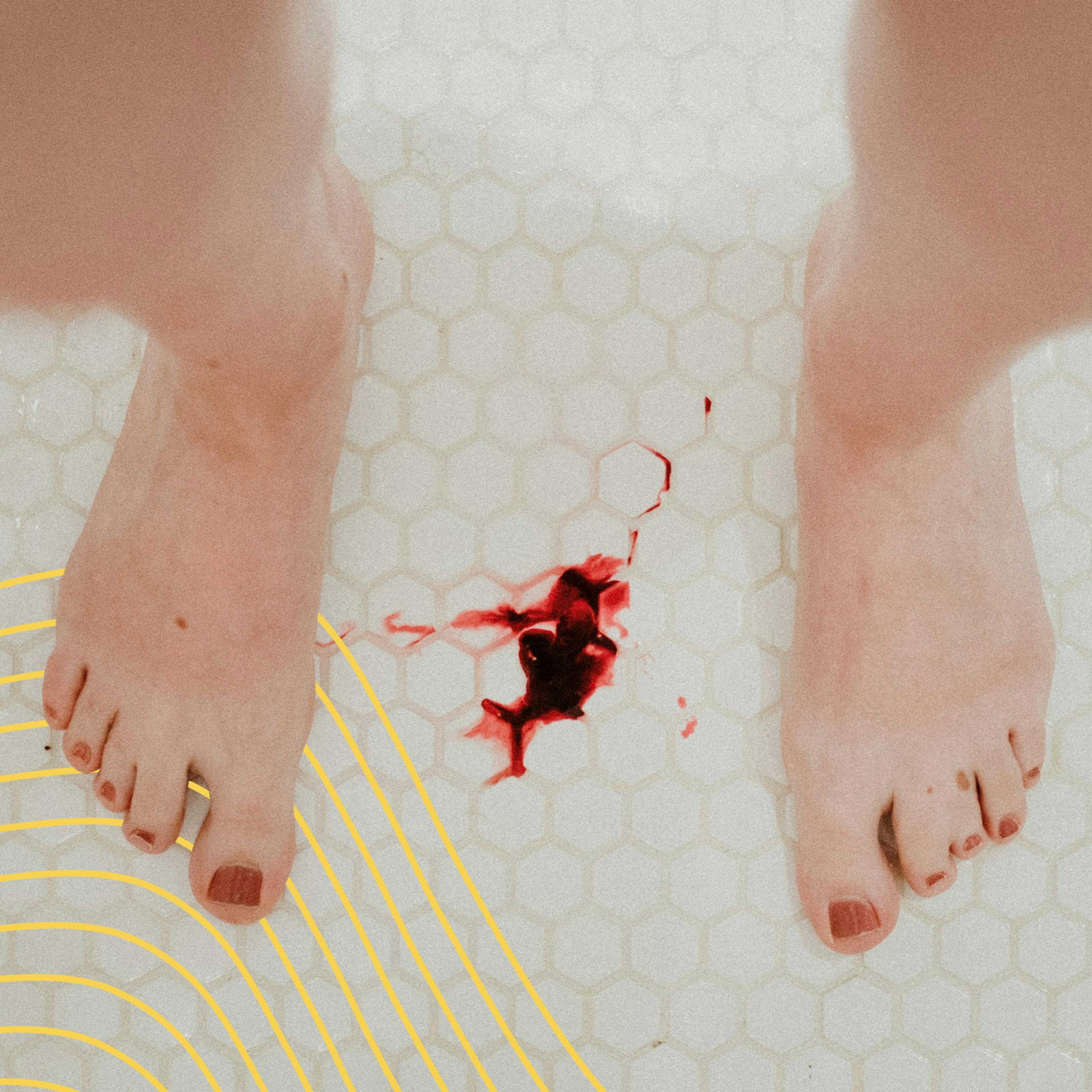 A woman bleeds on the floor following her miscarriage.