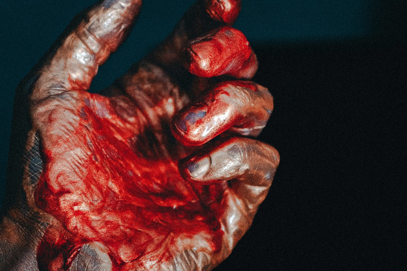 A hand covered in blood