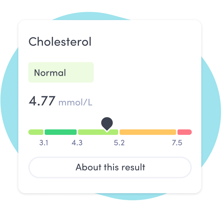 Cholesterol blood test results normal range