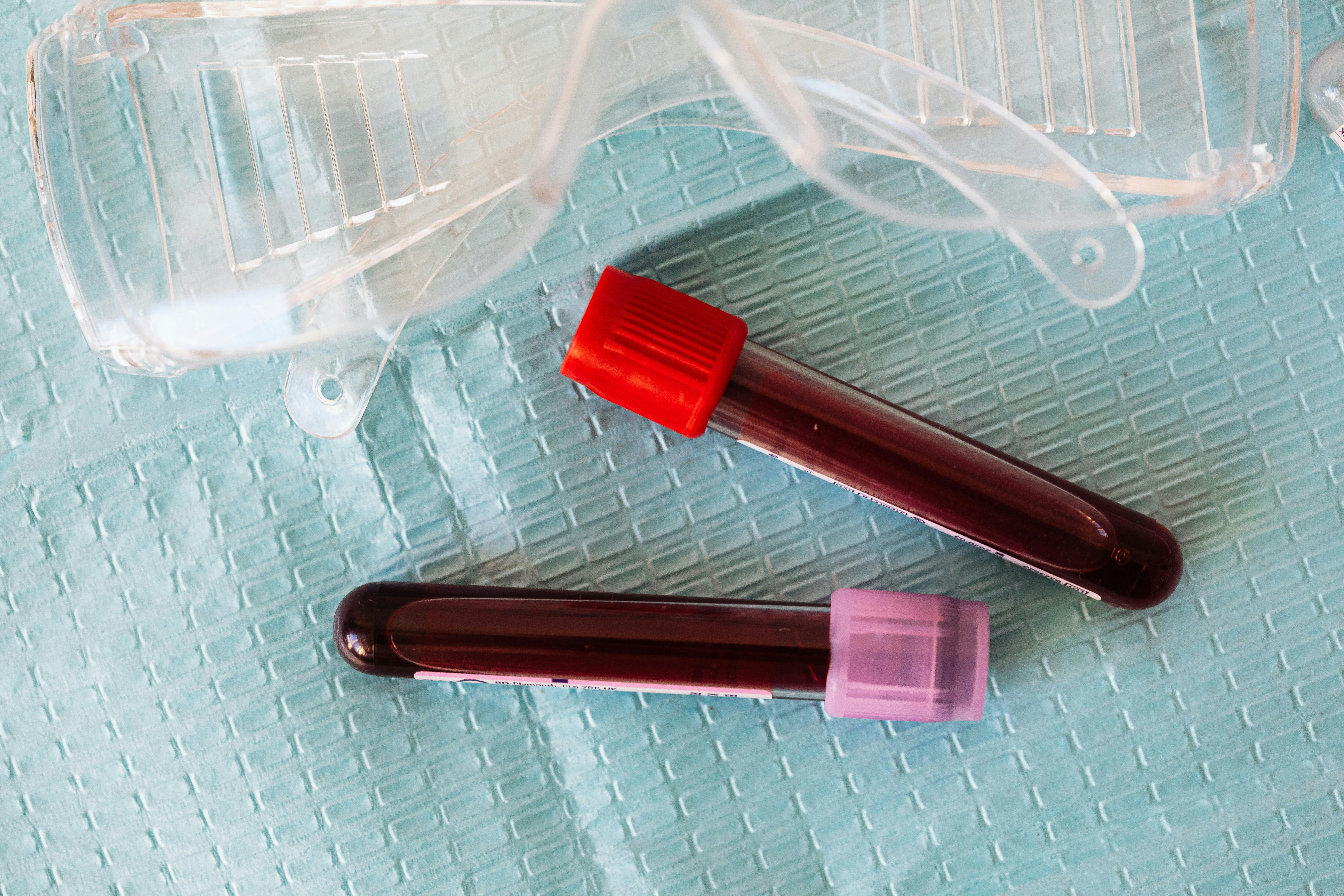Thyroid antibodies — blood samples in test tubes
