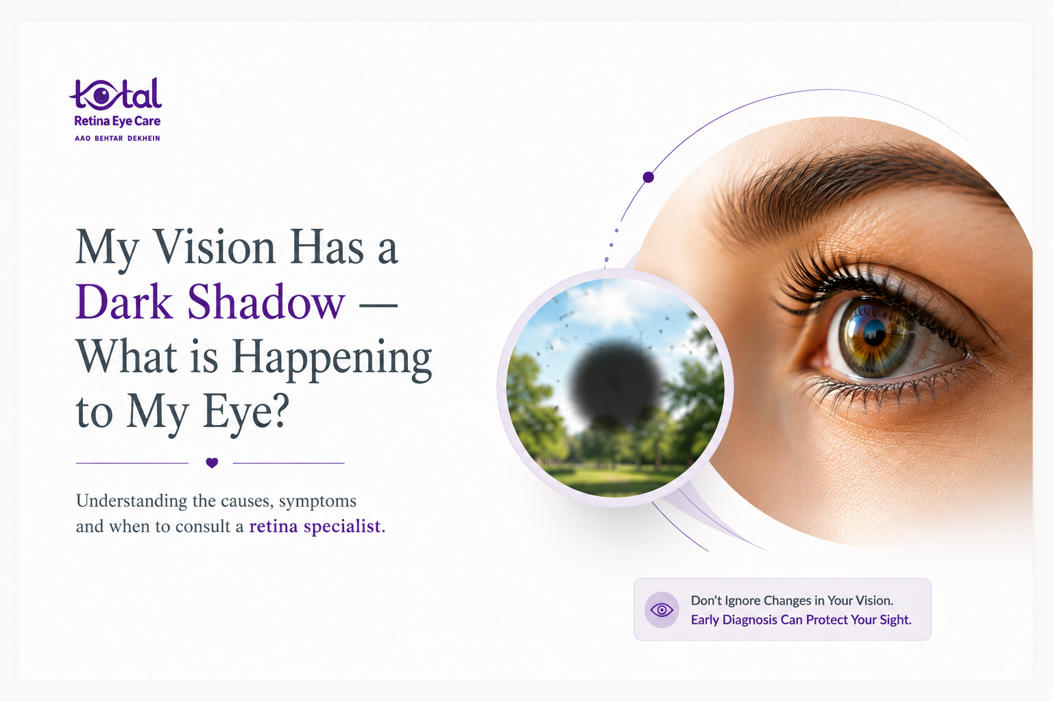 Dark Shadow in Vision? What It Could Mean for Your Eye Nagpur