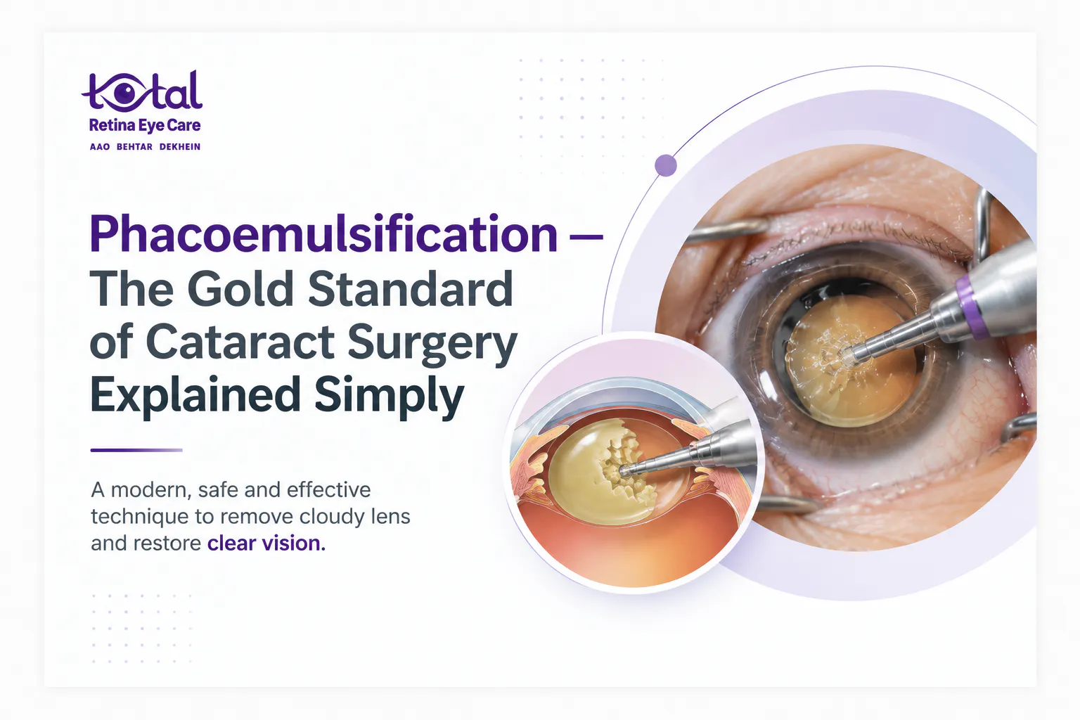 cataract specialist in Nagpur