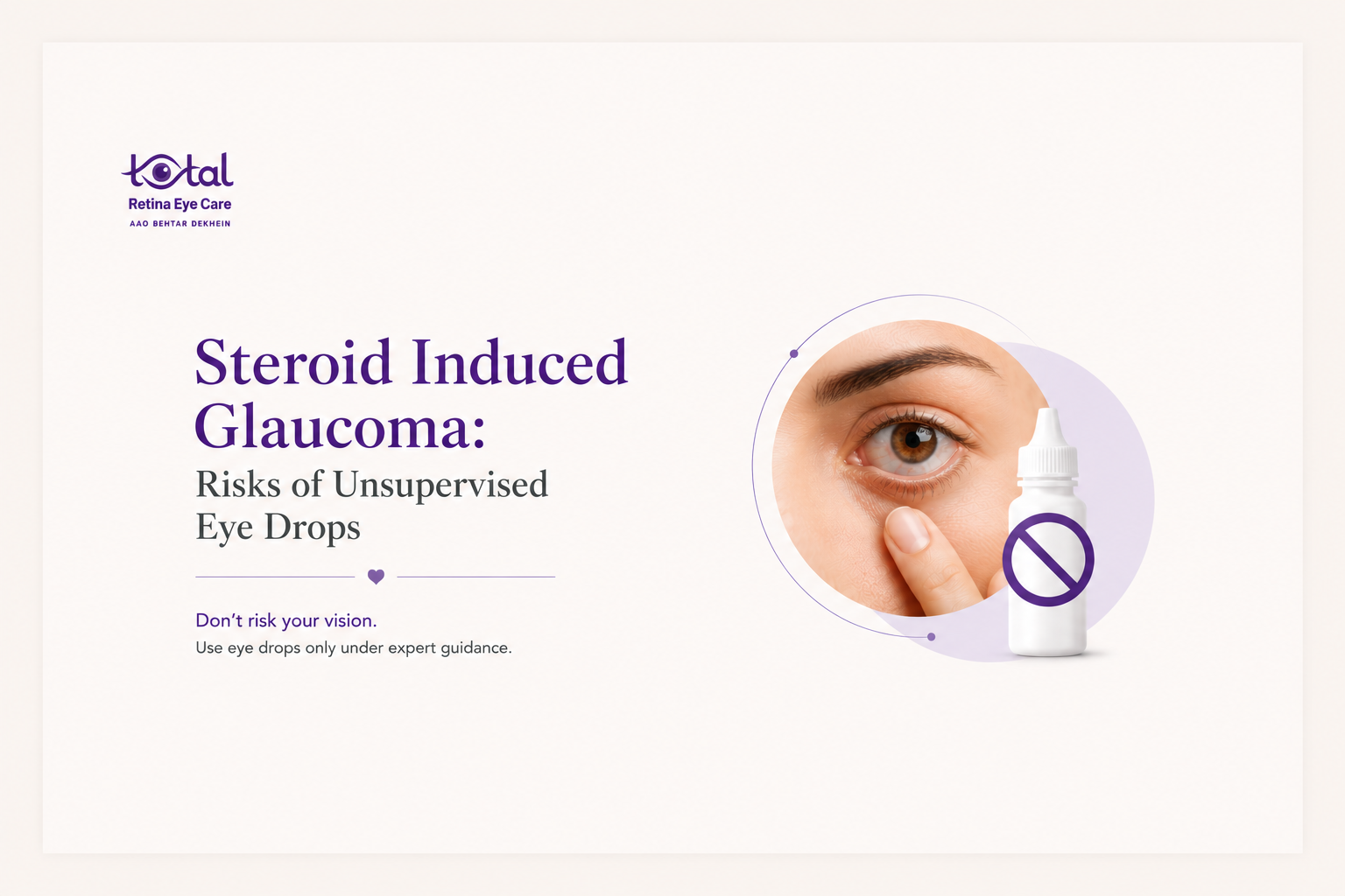 Steroid-Induced Glaucoma: Causes, Symptoms & Treatment | Glaucoma Treatment Nagpur.