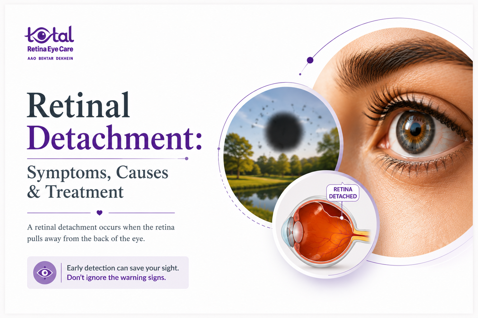 Best Eye Hospital in Nagpur for Retinal Detachment & Vitreoretinal Surgery