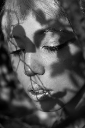 Freckles, Sunspots, or Melasma? Expert Weighs in on the Ultimate Guide to Hyperpigmentation: Types, Causes & What to do About it
