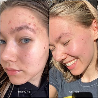 Truebotanicals Transformations
