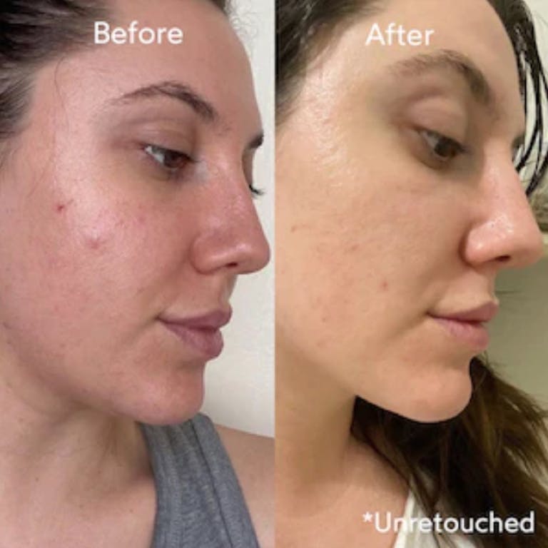 Truebotanicals Transformations