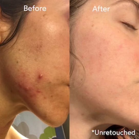 Truebotanicals Transformations