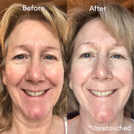 Truebotanicals Transformations