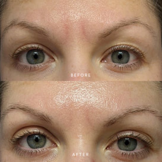Truebotanicals Transformations