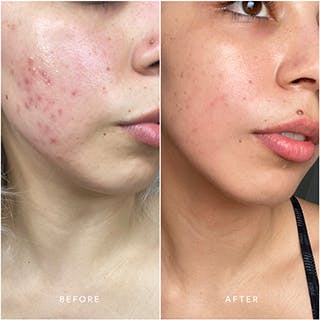 Truebotanicals Transformations
