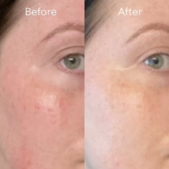 Truebotanicals Transformations