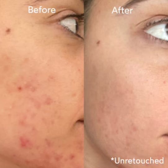 Truebotanicals Transformations