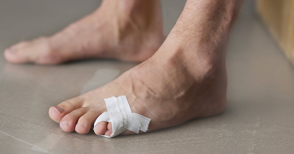 Gebrochen Zeh Tapen Anleitung Dachziegelverband Deine Tapinganleitung für den Dachziegelverband