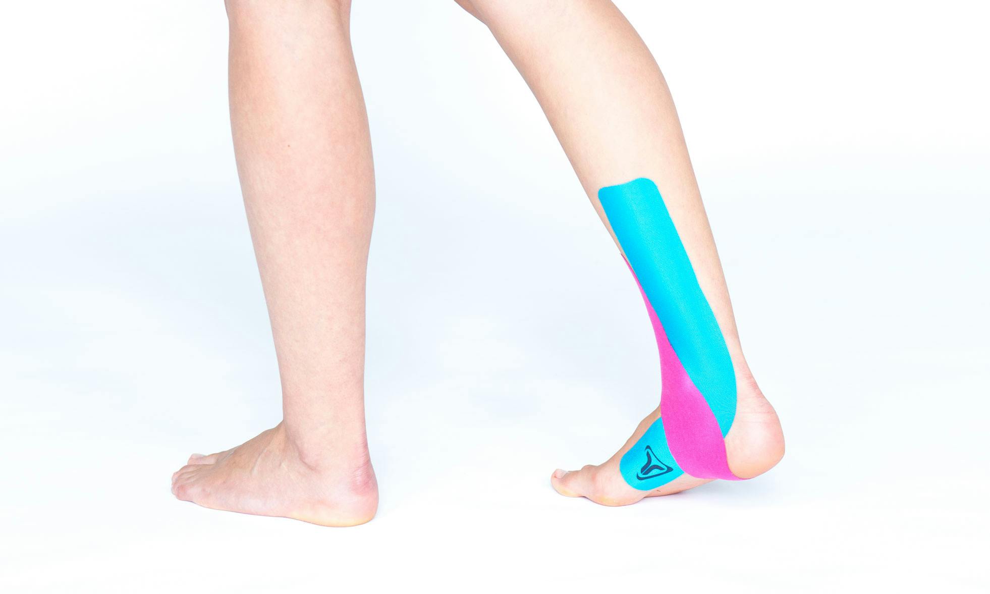 medial tibial stress syndrome taping