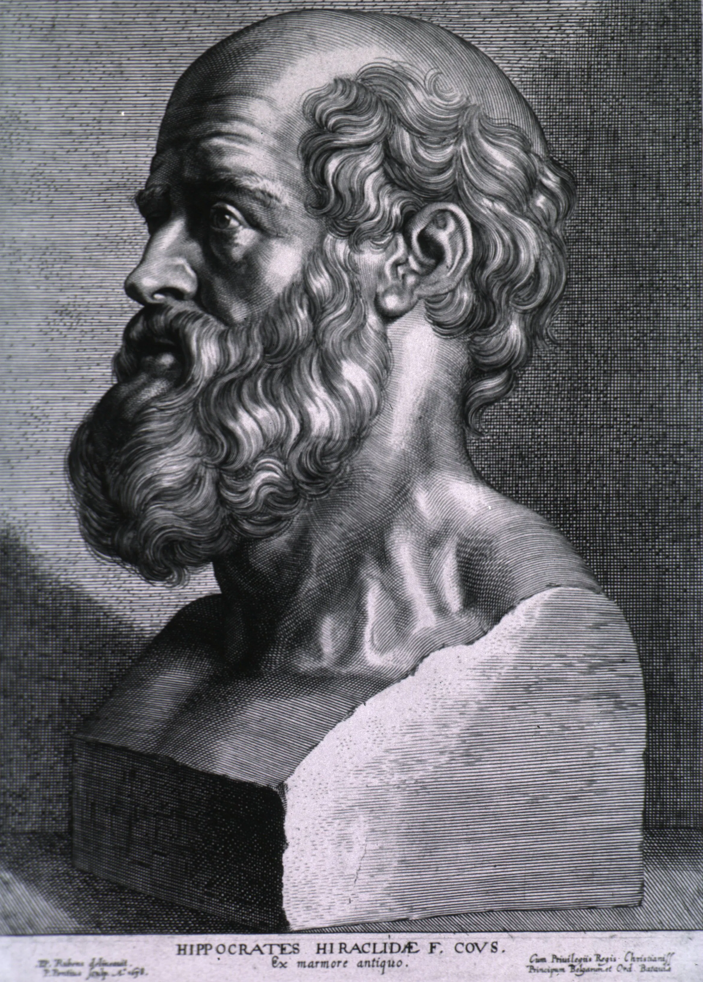 This engraved portrait of Hippocrates after Rubens presents the ancient physician as the kind of classical authority invoked when λοιμὸν, the Epidemics, and Celsus are enlisted to give a new medical distinction the force of precedent. Its early modern form is apt: Berger and Vater do not merely repeat antiquity, but translate venerable names and terms into a contemporary argumentative framework.