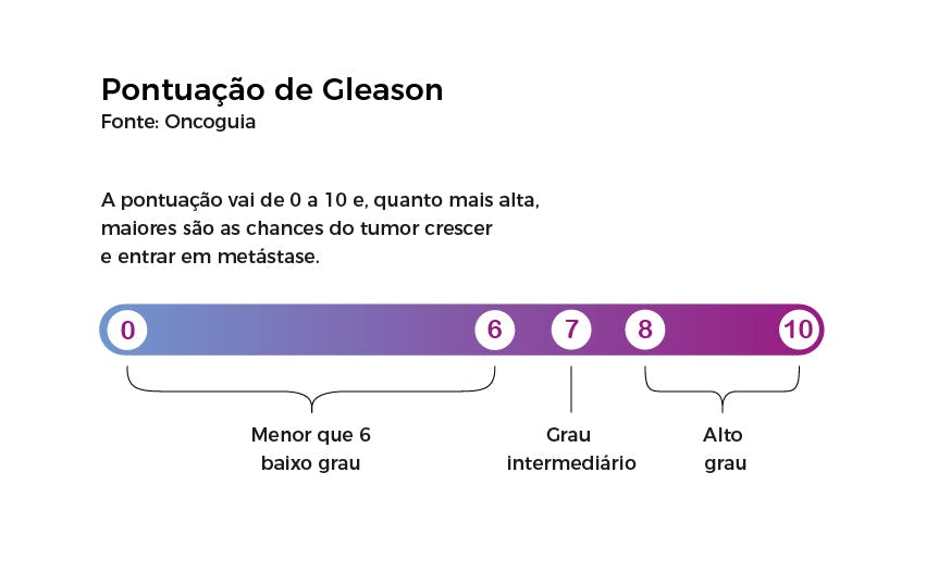 cancer de próstata grau 6
