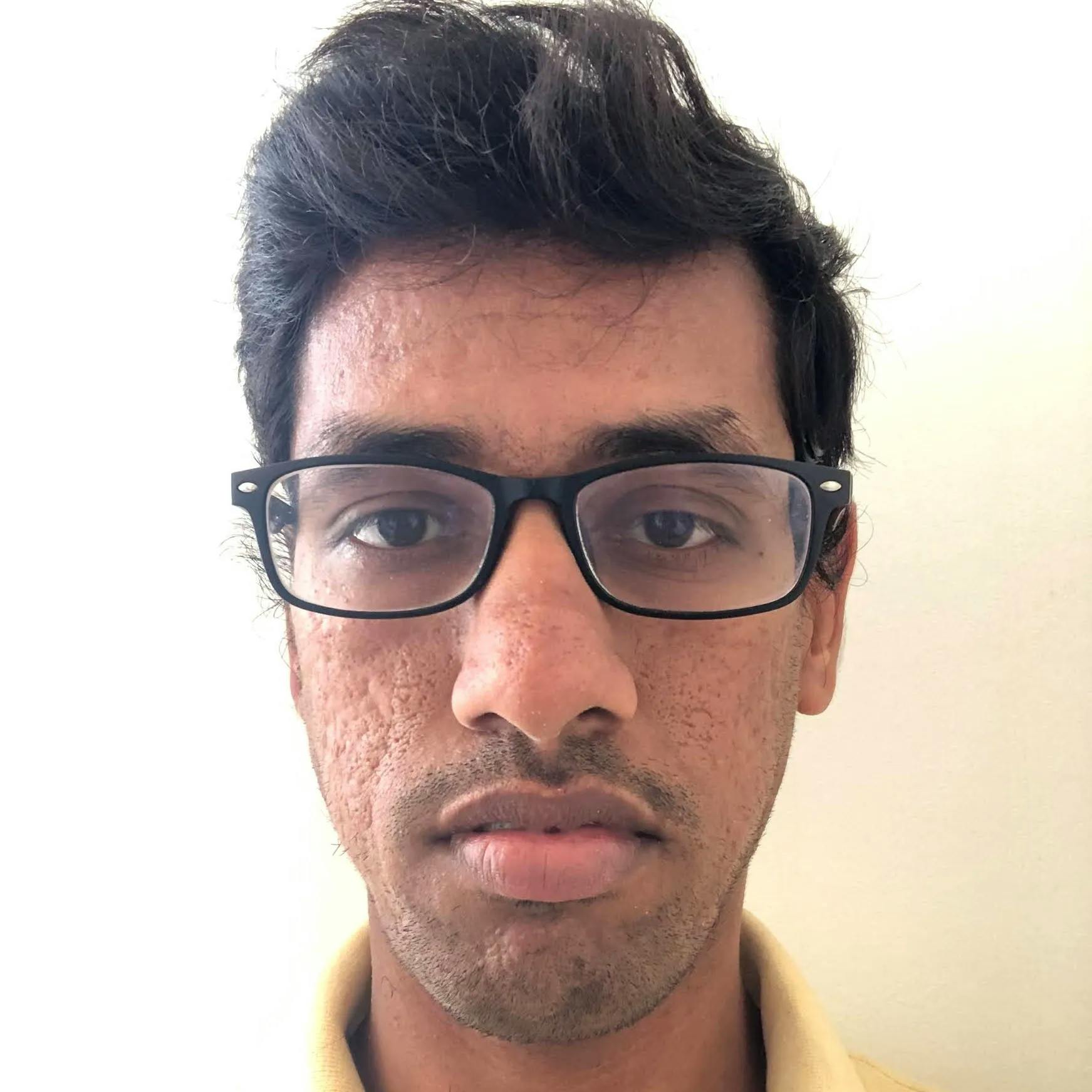 100 Scala Interview Questions and Answers for 2025 | Turing