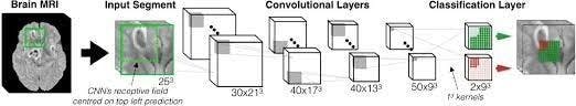 3D Deep Learning model used for image classification.webp