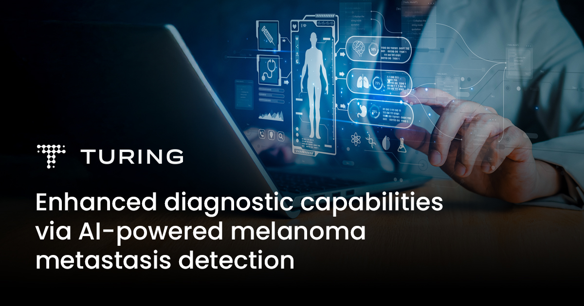 Healthcare AI Case Study: Advancing Melanoma Detection