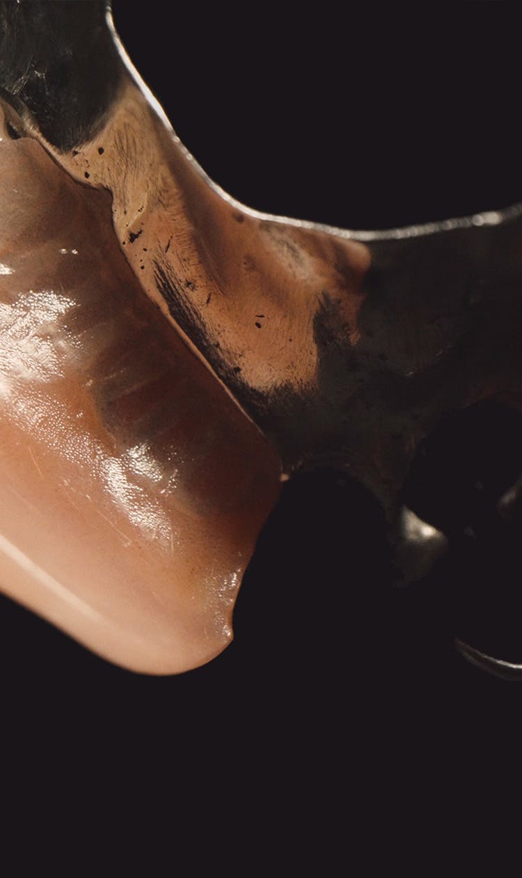 Prevention & Treatment