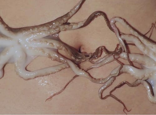 A photography of an octopus twining on a person's belly.