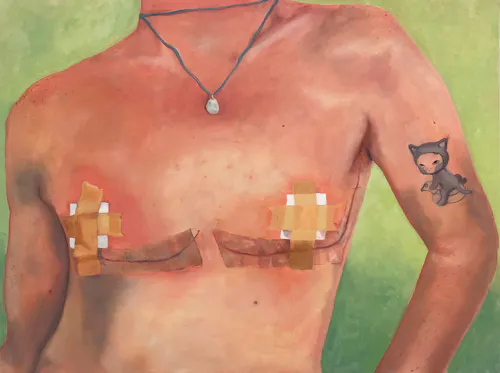 Oil painting of a person's chest after top surgery with long scars and bandages over their nipples.
