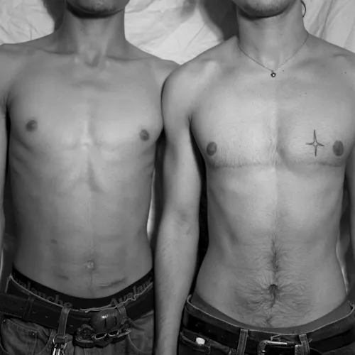 Two young men stand shoulder to shoulder, only their arms, torsos and belts visible. The man on the right has two scars on his chest below his pectorals, and a tattoo of a star on the righthand side of his chest. The man on the left has three scars upon his stomach. The lowest scar is long, horizontal and below his naval. The other two scars are shorter, one to the left of the long scar and the other a few inches above.