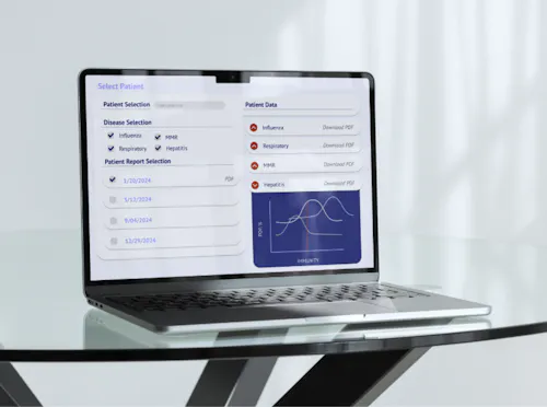 An open laptop sits on a glass table, a grey backdrop behind it. The screen displays a intranet UI used for data visualizations.