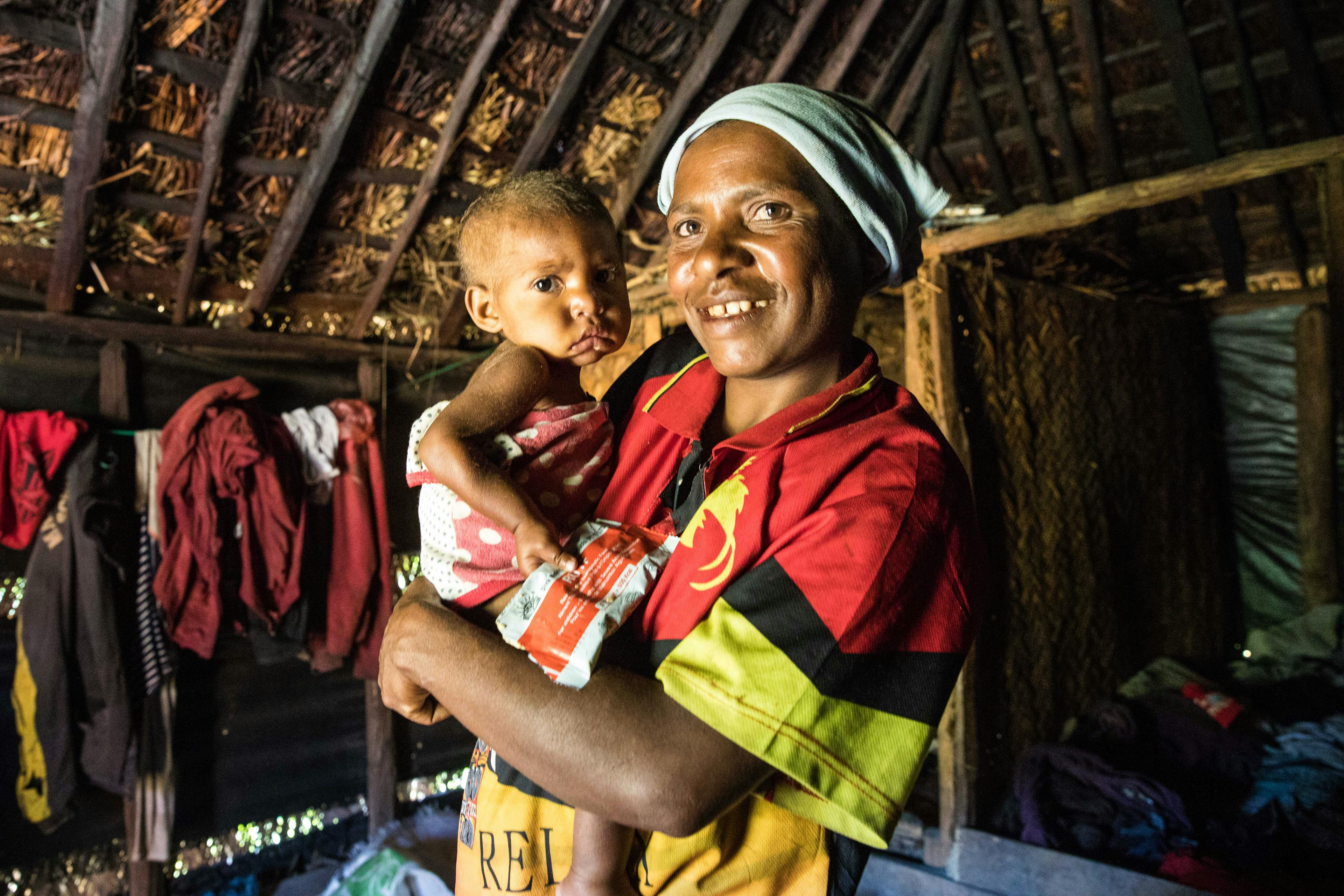 Julie Myron's daughter, Adaline (1 year 5 months) is severly malnourished and has just started a on a nutrition program as part of UNICEF's support to earthquake affected communities in Mendi, Southern Highlands Province.