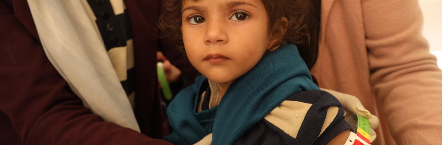 Leen, 2-year-old, is getting her middle-upper-arm-circumference (MUAC) measured, her MUAC reads less than 10, indicating sever acute malnutrition and drastic weight loss and muscle atrophy