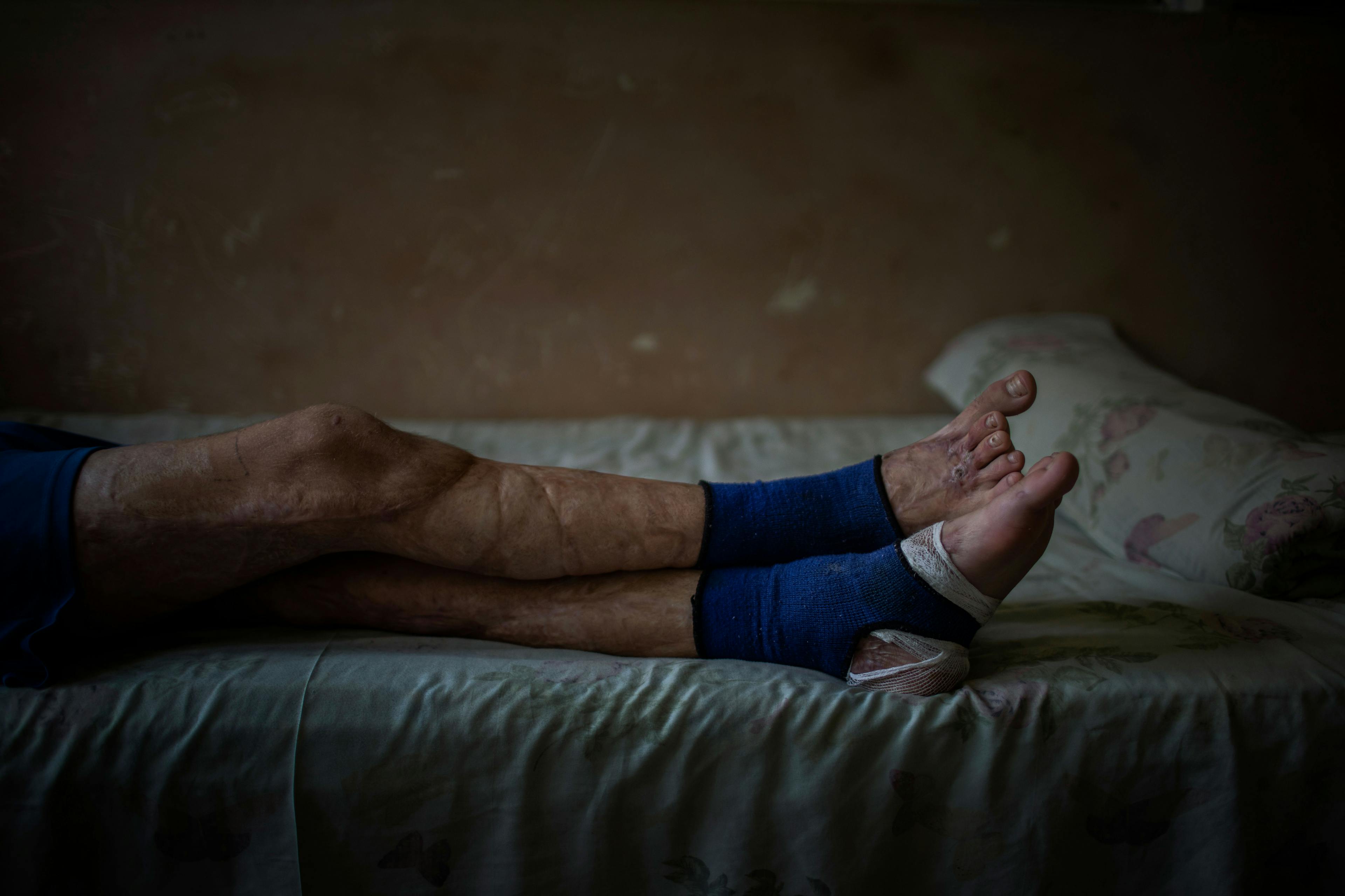 On 24 September 2022 in Lviv, Ukraine, 12-year-old Mykhailo Baev rests on a bed at Saint Nicholas Pediatric Hospital. On 7 July, a rocket landed in his family’s yard, killing his father and injuring Mykhailo and his little brother, Kyrylo, 10.