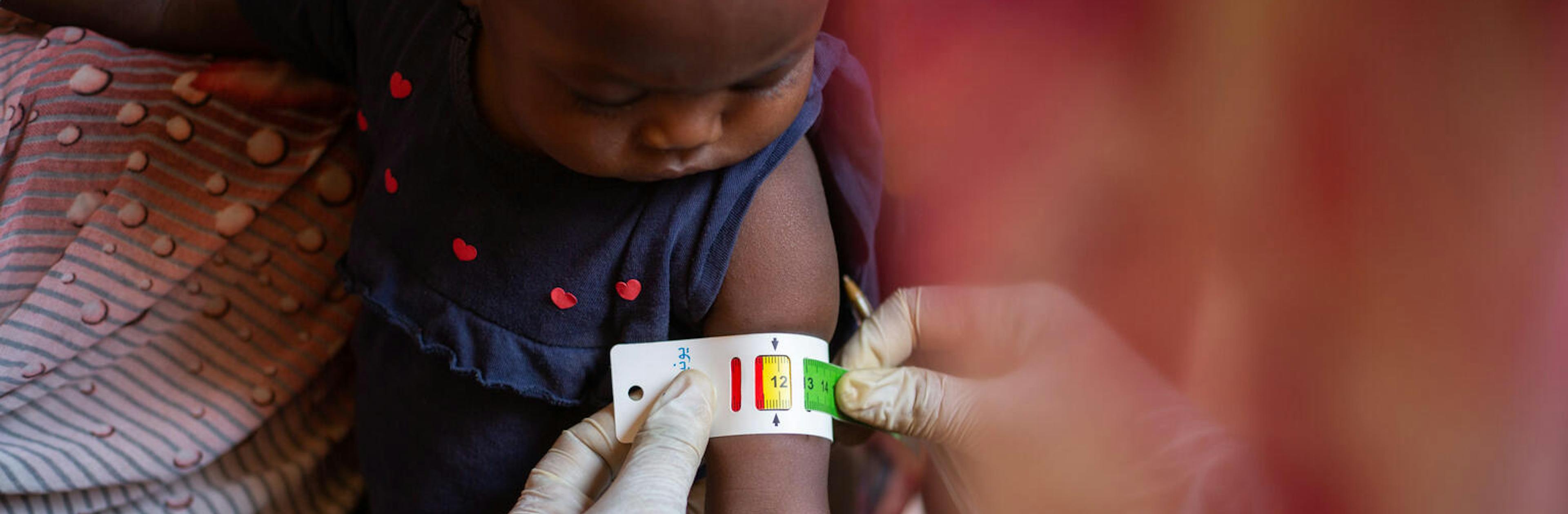 Catching signs of malnutrition early - a child is screened for malnutrition using a MUAC band