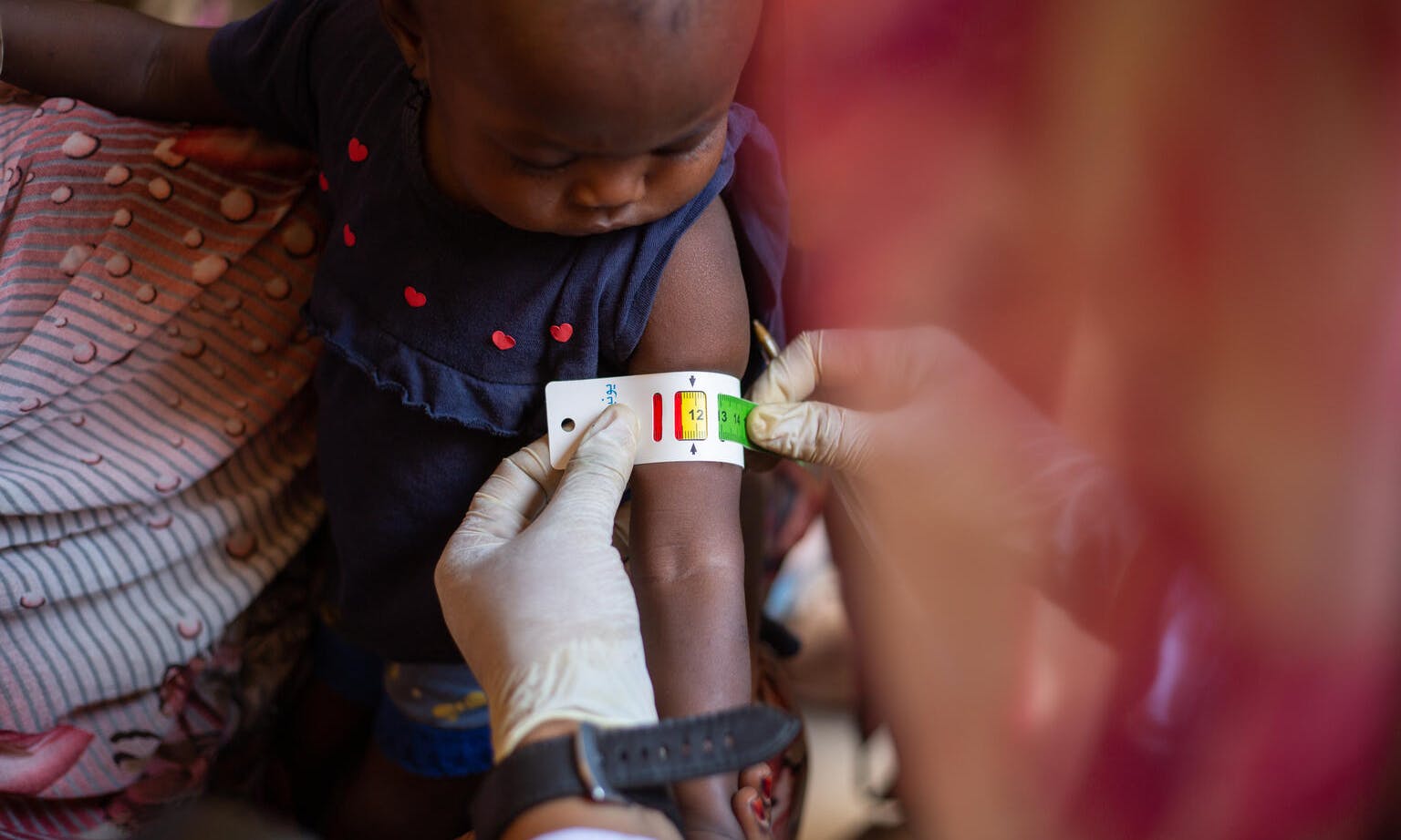 Catching signs of malnutrition early - a child is screened for malnutrition using a MUAC band