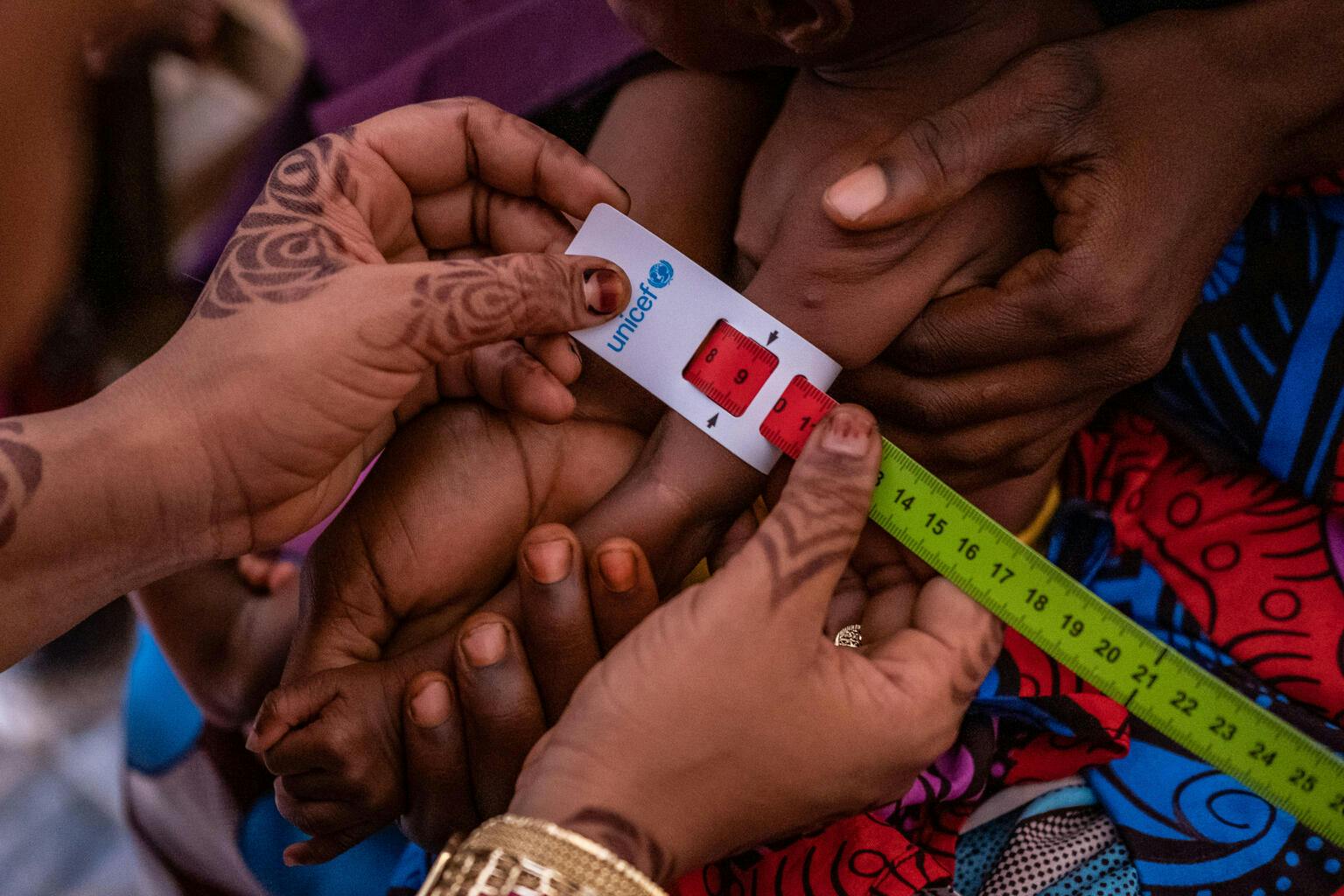 Catching signs of malnutrition early - a child is screened for malnutrition using a MUAC band