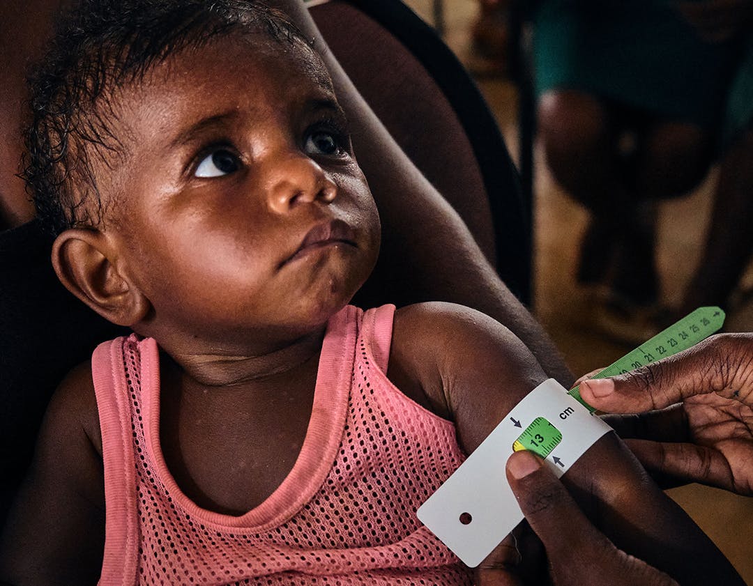 Martha (10months) is being tested for malnutrition by Esther, the UNICEF health specialist.