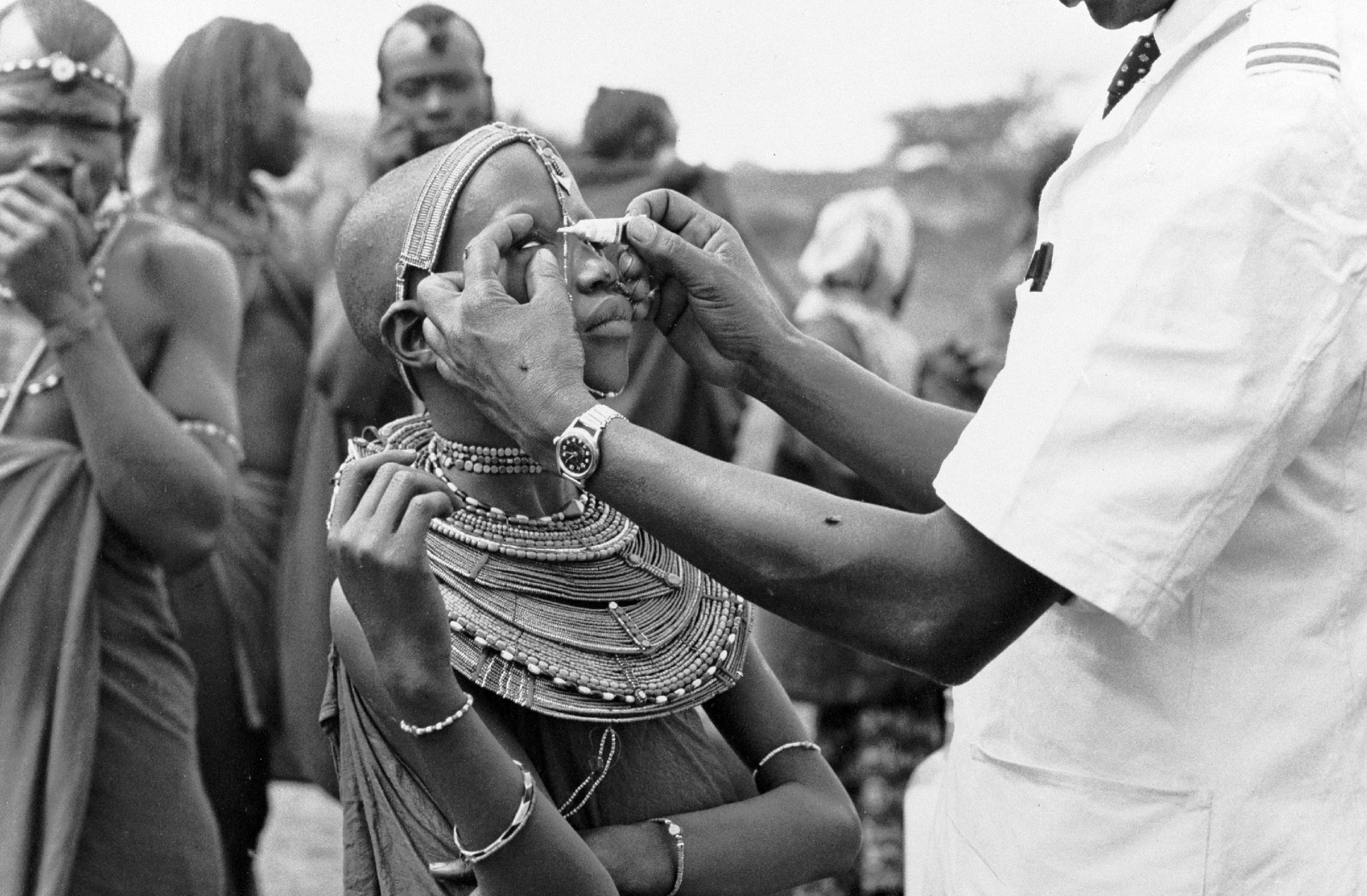 A man health worker from a UNICEF-assisted mobile health unit applies antibiotic ointment to the eye of an indigenous girl from the nomadic Masai ethnic group during a demonstration in a Masai community camped at Olobelibel. 